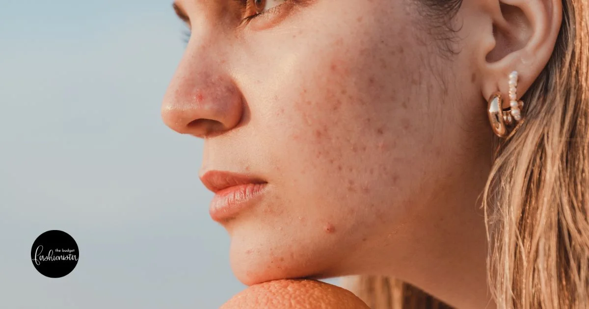 Woman's clear skin close-up illustrating a practical blemish routine